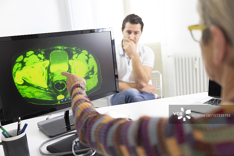 前列腺超声波图片素材