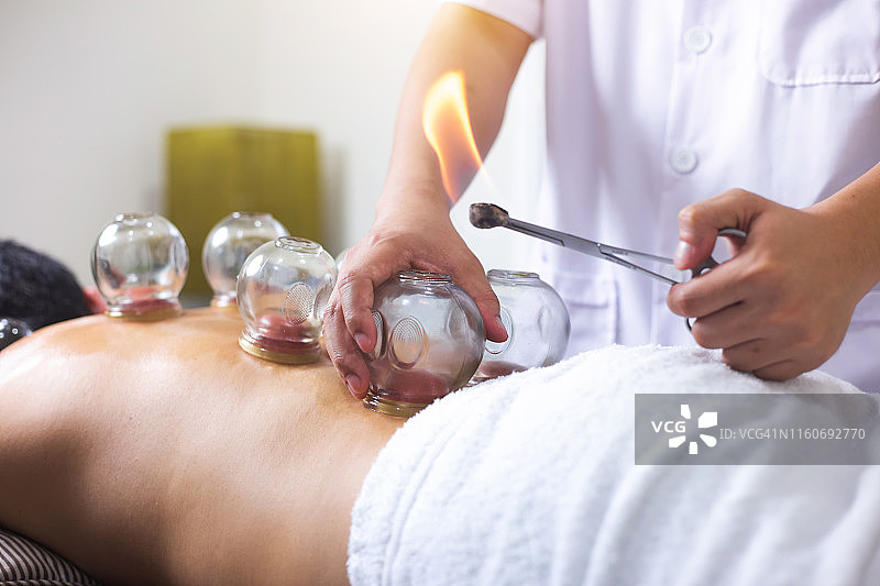 中国传统医学针灸疗法图片素材