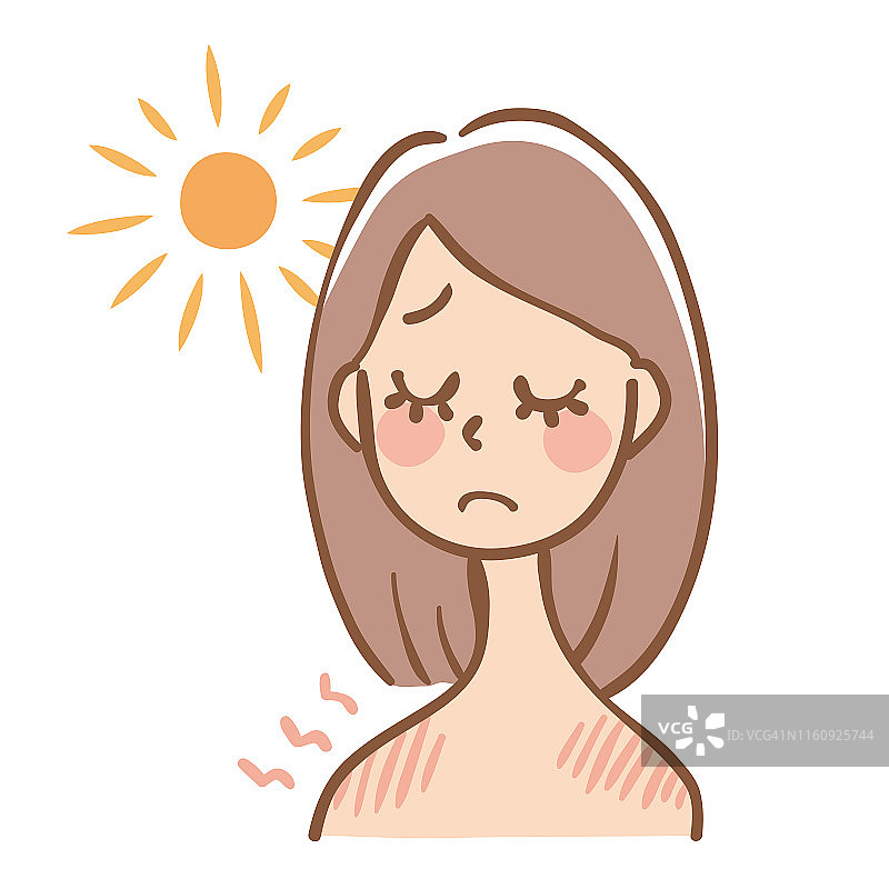 晒伤皮肤发红的女人图片素材
