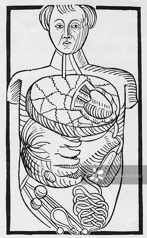 内脏异位图图片素材