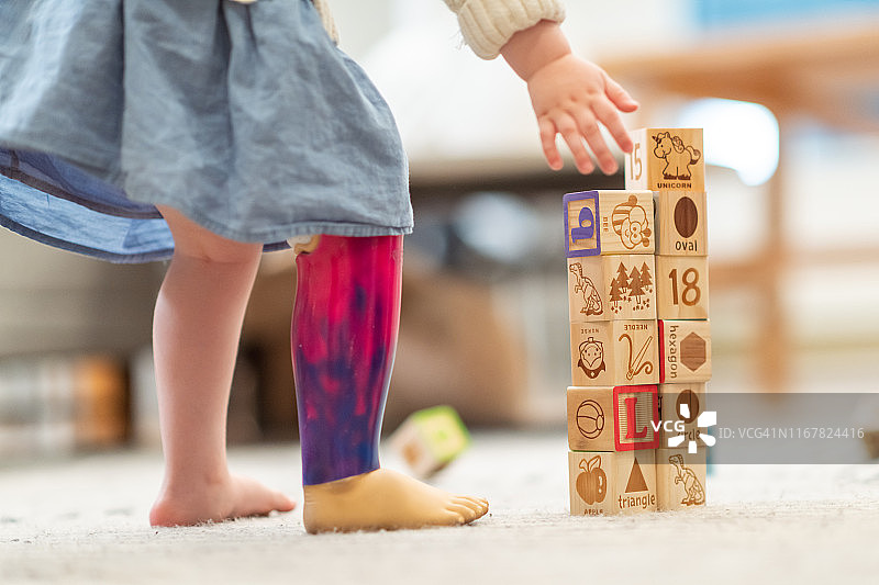 小女孩假肢特写镜头图片素材