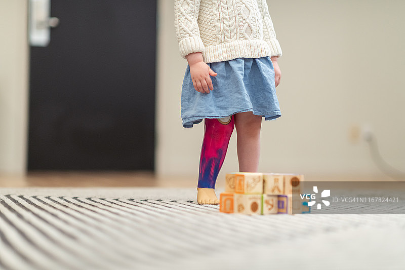 小女孩假肢特写镜头图片素材