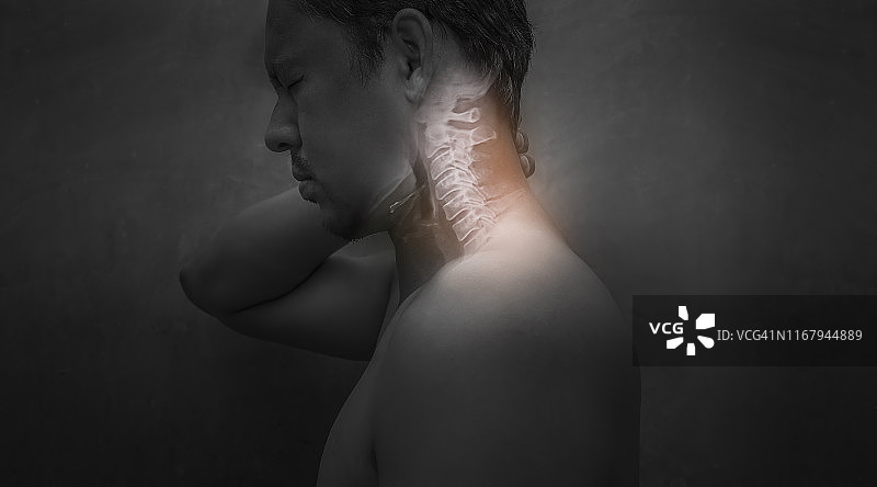 因颈椎病而颈部疼痛的男人，需要尽快就医图片素材