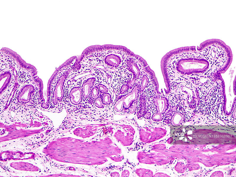 柱状上皮细胞10倍光学显微照片图片素材