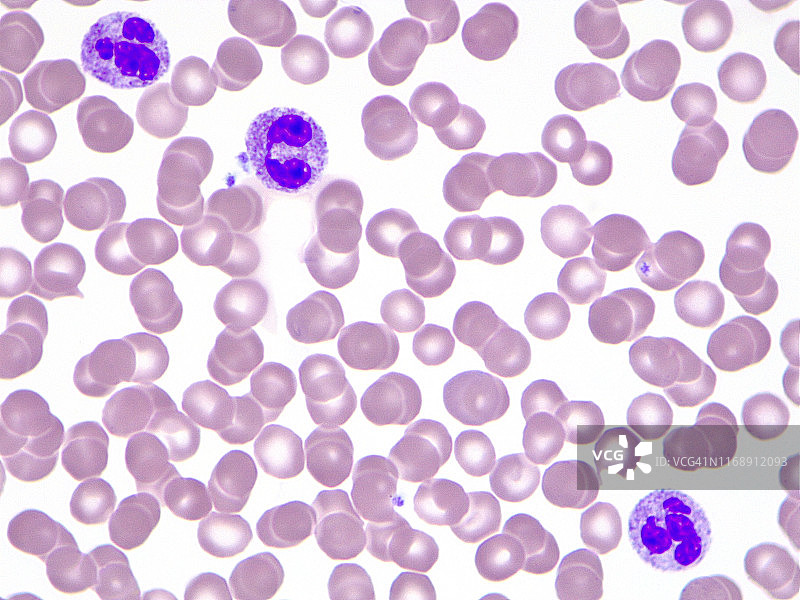 具有嗜中性粒细胞的血细胞，100倍光学显微照片图片素材