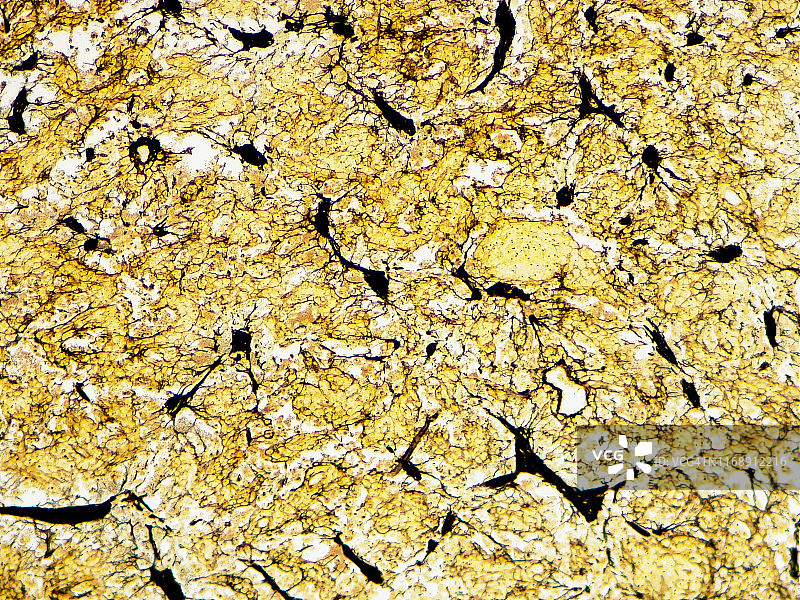 淋巴结，10倍光学显微照片图片素材