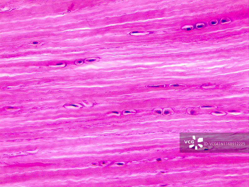 纤维软骨，40倍光学显微照片图片素材
