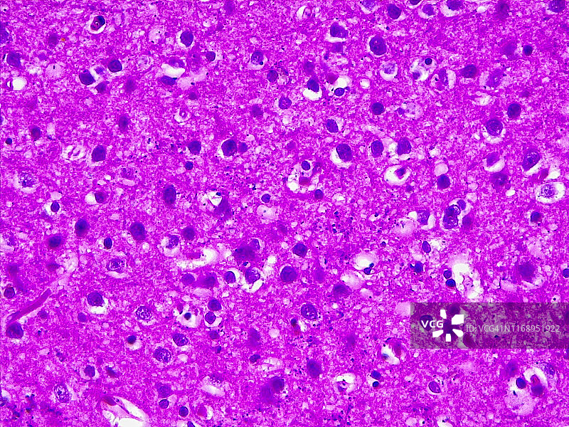 大脑皮层外颗粒层，40倍光学显微镜图片素材