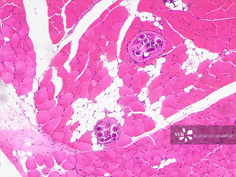旋毛虫的10倍光学显微照片图片素材
