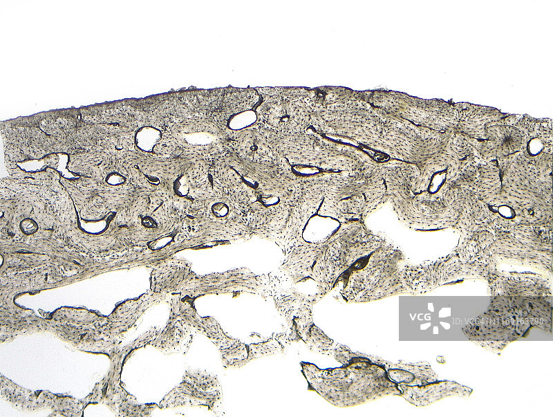 致密骨横截面，4倍光学显微照片图片素材
