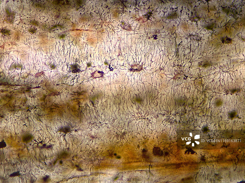 致密骨纵向地面部分，40倍光学显微照片图片素材