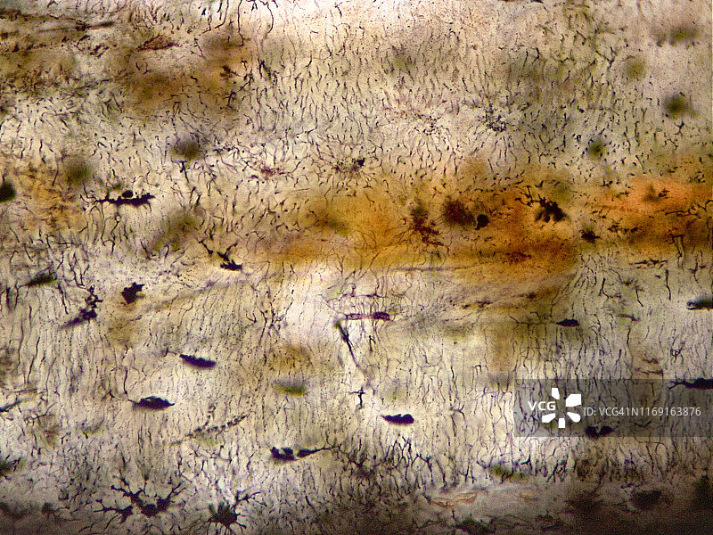 致密骨纵向地面部分，40倍光学显微照片图片素材