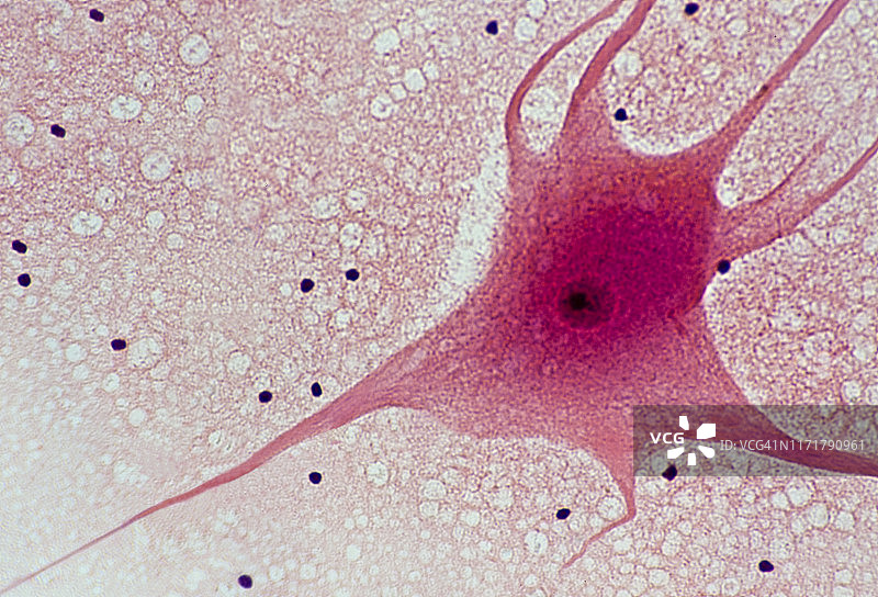 脊髓运动神经元细胞体、树突和轴突，100倍图片素材