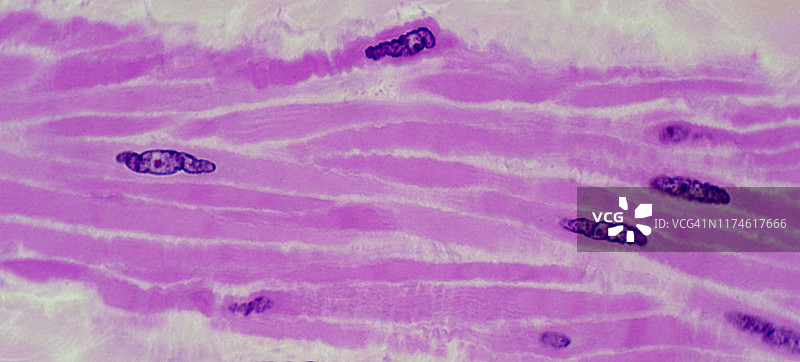 膀胱中的平滑肌 250倍图片素材