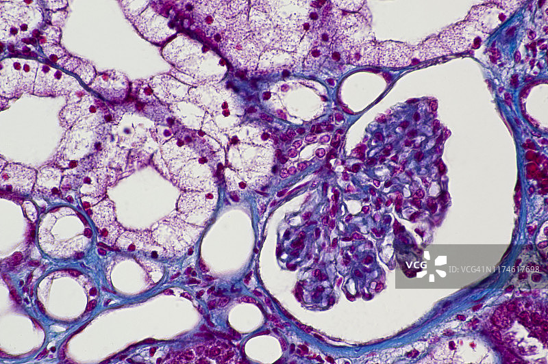 肾单位、肾小体和肾小管——肾小球、鲍曼囊、致密斑、远曲小管、近曲小管，100倍图片素材