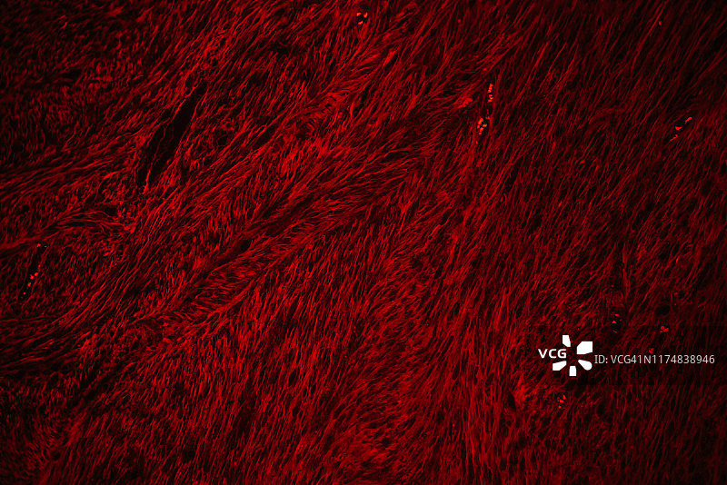 人肿瘤组织平滑肌肉瘤的红色荧光显微照片图片素材