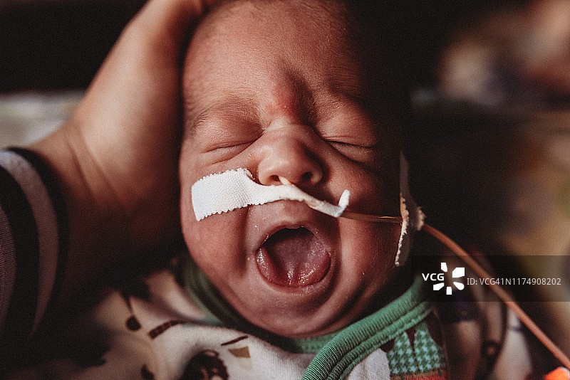 早产29周的双胞胎在医院的NICU里被母亲抱在怀里哭泣图片素材