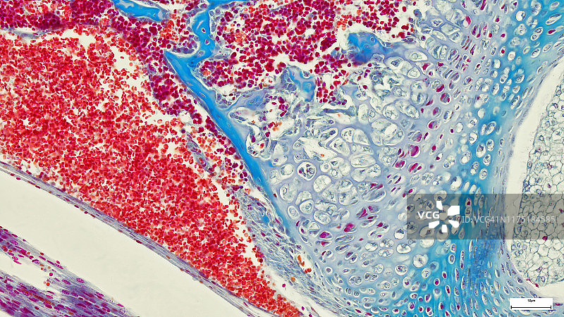 软骨组织、海绵骨和血肿（动物，小鼠）图片素材
