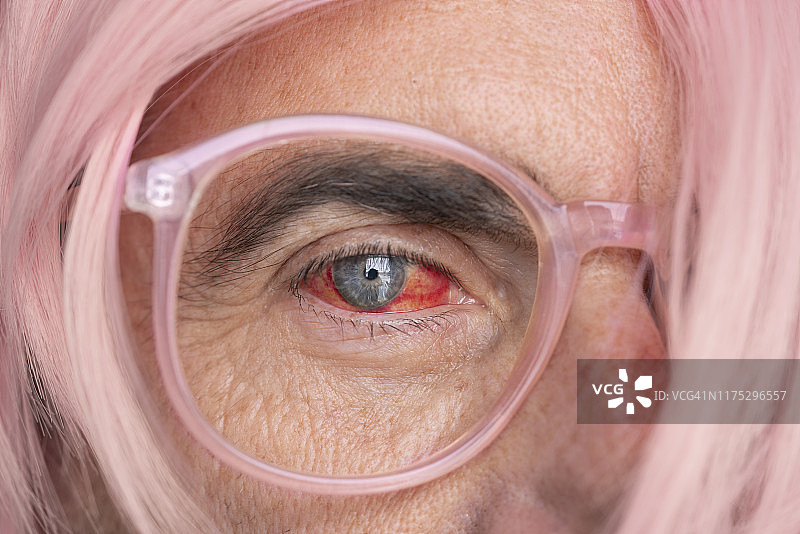 成熟成年人眼部积液特写图片素材