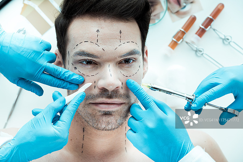 整形外科图片素材