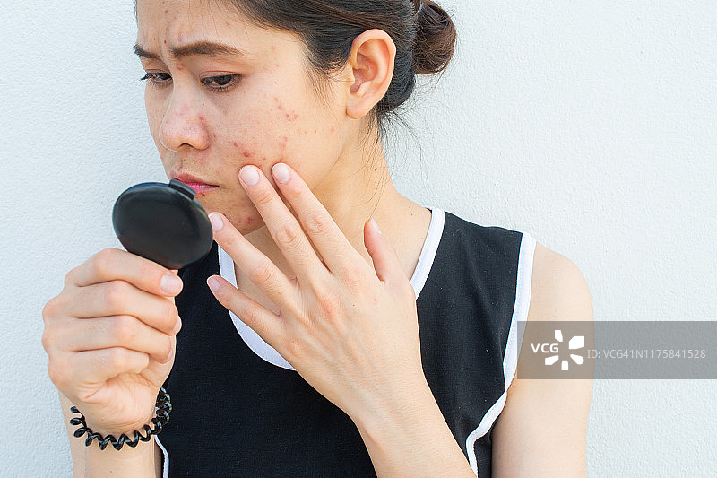 照镜子时为痘痘和疤痕问题担心的亚洲女性肖像图片素材