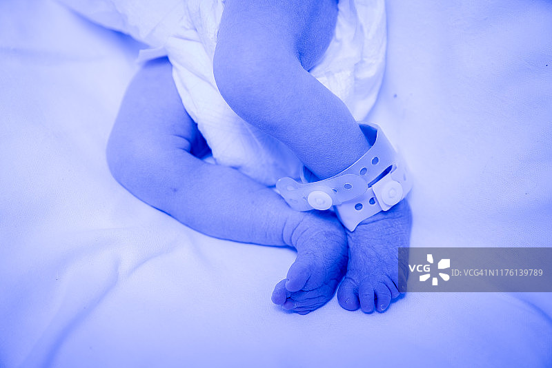 接受光疗的新生婴儿的小脚图片素材