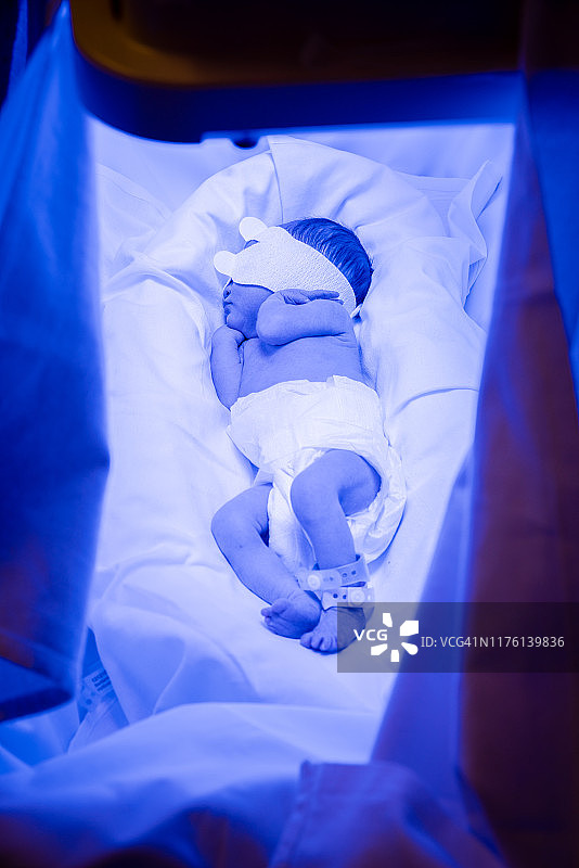接受光疗的新生儿图片素材