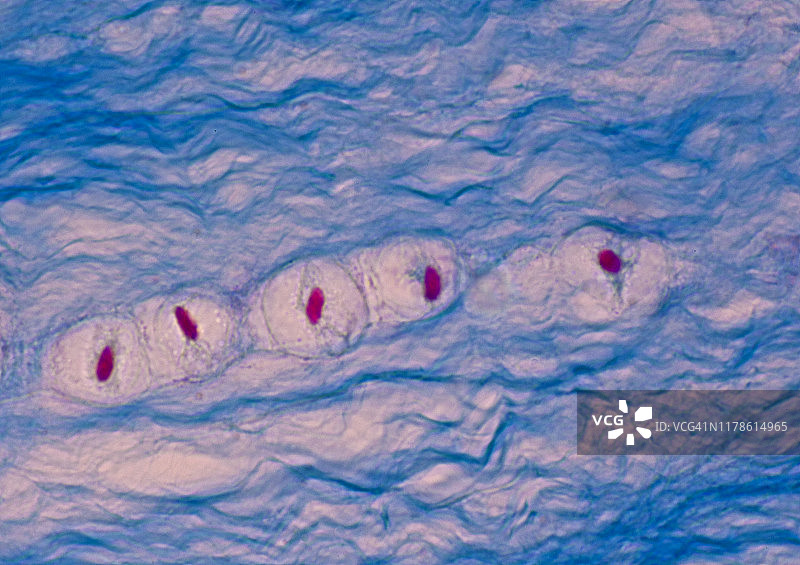 纤维软骨——软骨细胞陷窝胶原纤维，椎间盘，250倍图片素材