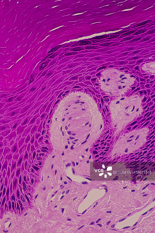 皮肤真皮中的触觉感受器——帕西尼安小体，250倍放大图片素材