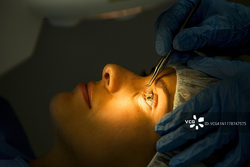 激光眼科手术图片素材