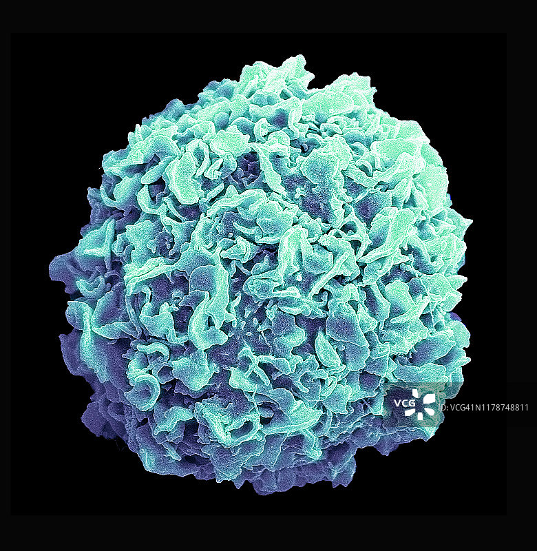 乳腺癌细胞扫描电镜图图片素材