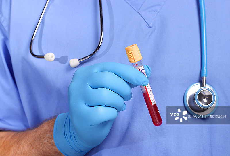 医生手持装有血液的试管图片素材