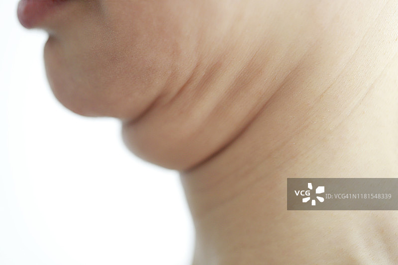 中年妇女的双下巴特写图片素材