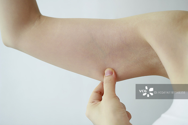 女人捏手臂皮肤图片素材