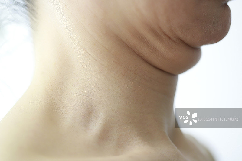 年长女性的双下巴特写图片素材