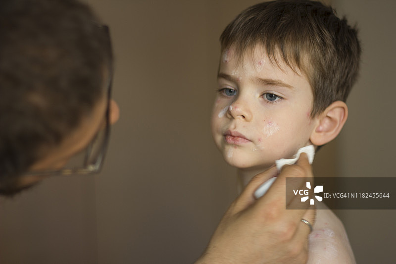 通过天花进行治疗图片素材