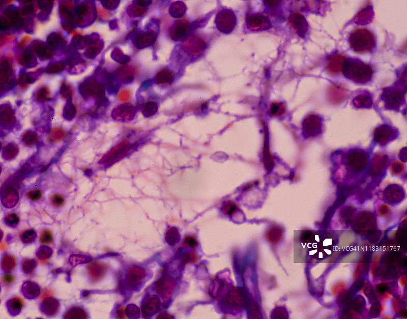 淋巴结中的网状结缔组织纤维，250倍图片素材