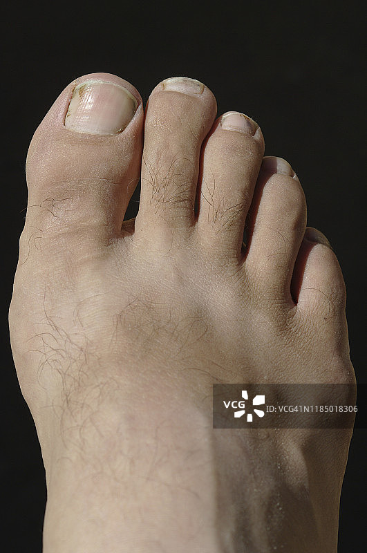 2009年非洲莫桑比克-人类的脚，白人男性图片素材