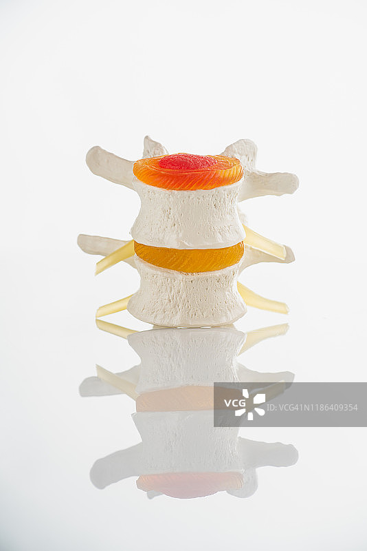 椎骨和椎间盘神经退行性疾病图片素材