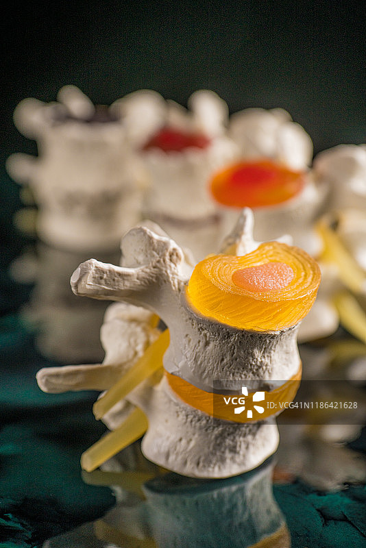 椎骨和椎间盘神经退行性疾病图片素材