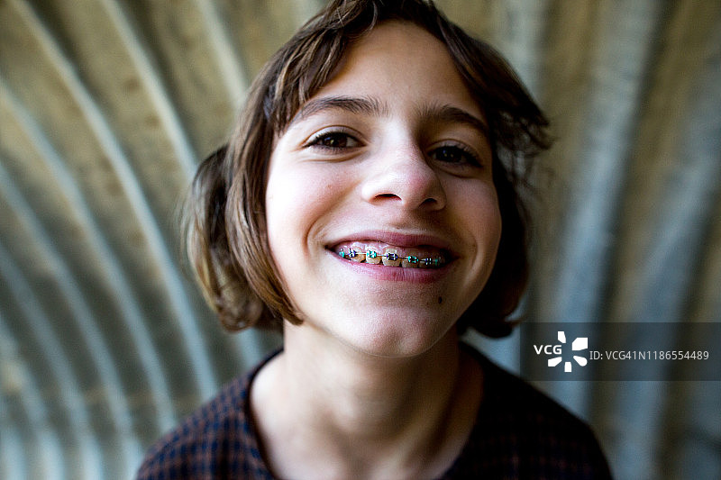 戴着牙套微笑的女孩特写图片素材