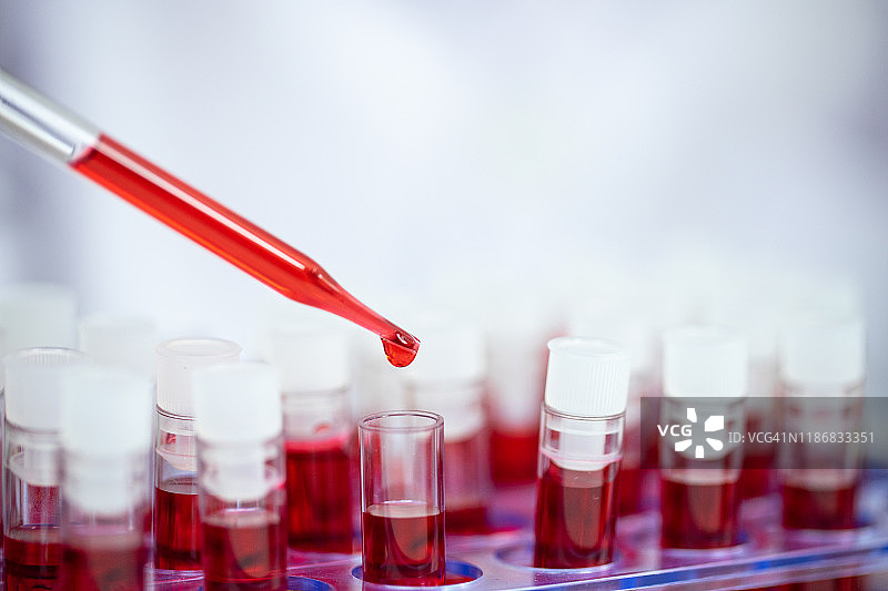 健康护理：血液检测与研究图片素材