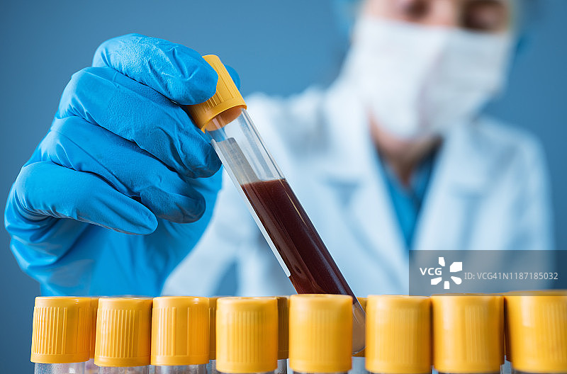 血液检测图片素材