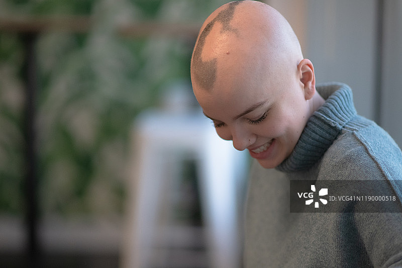 患有脱发的年轻女人笑着的库存照片图片素材