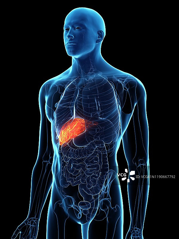 患病肝脏概念图图片素材