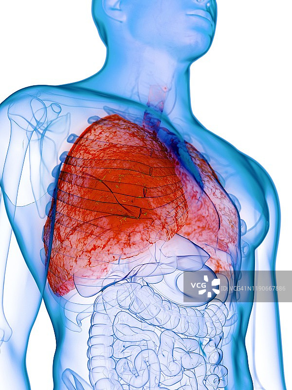 患病肺部概念图图片素材
