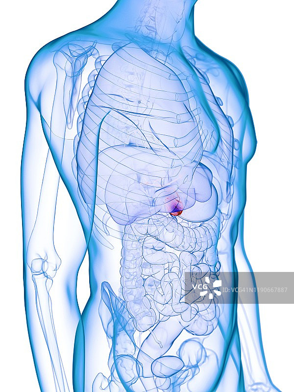 病变的胆囊概念图图片素材