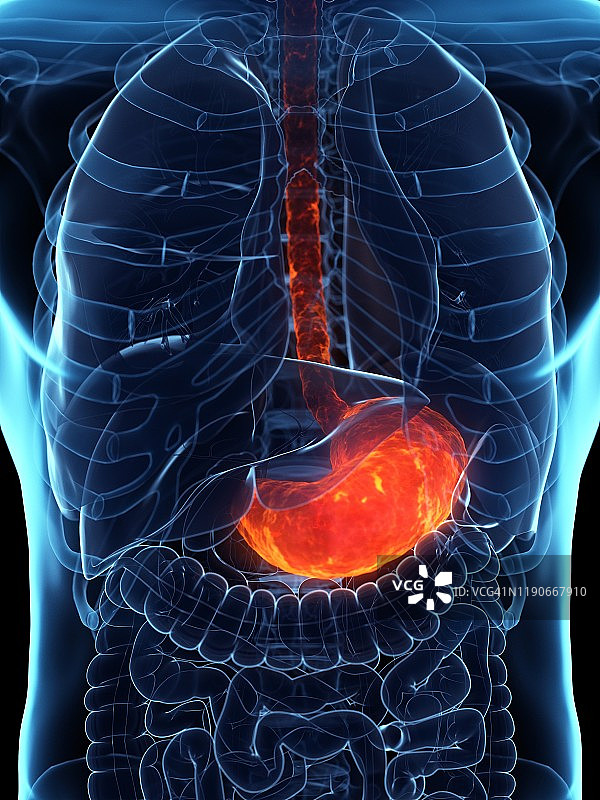 患病胃部概念图图片素材