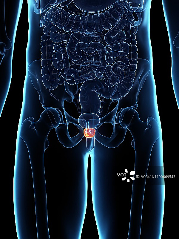 前列腺炎症插图图片素材