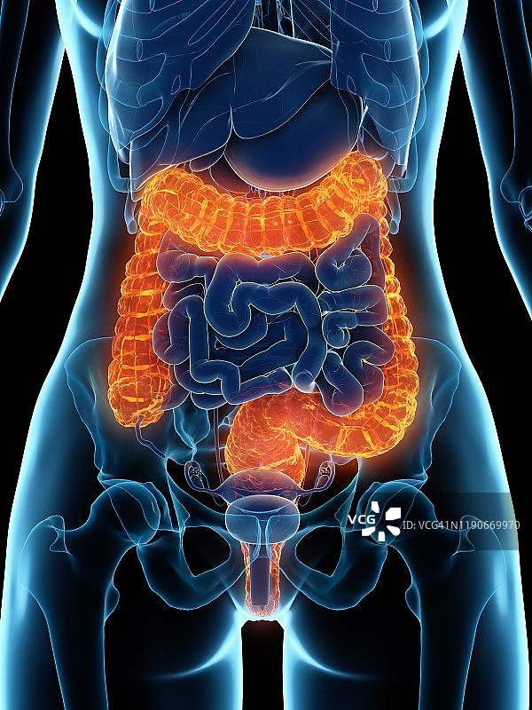 患病结肠插图图片素材